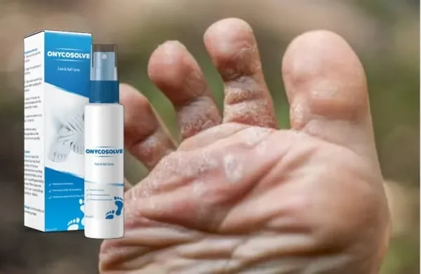 Exofeet oil : къде да купя в България, в аптека?